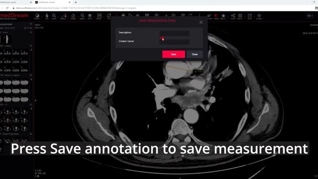 MedDream DICOM Viewer: save an annotation смотреть онлайн