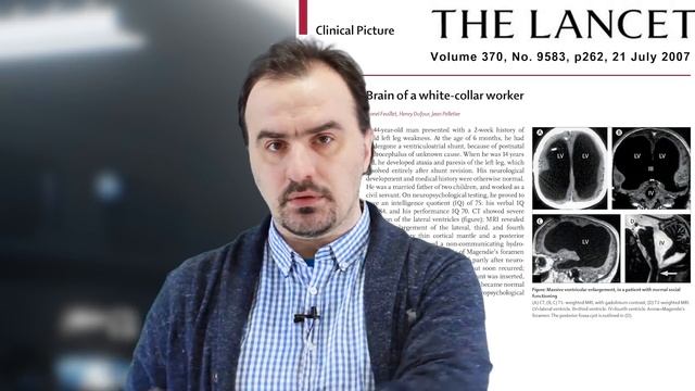 Можно ли жить без мозга? И каково это? смотреть онлайн