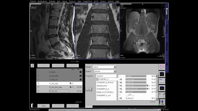 L spine MRI positioning смотреть онлайн