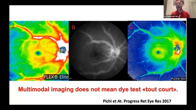OCT & OCTA in Uveitis | Uveitis Up-to-date 3 смотреть онлайн