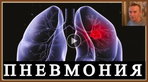 ПНЕВМОНИЯ - ВОСПАЛЕНИЕ ЛЕГКИХ