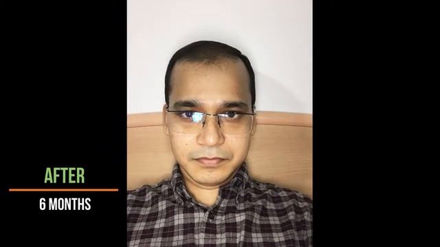 Neo Hair Lotion review 2020 | Neo Hair Lotion отзывы 2020 смотреть онлайн