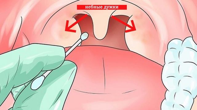 Памятка по самозабору анализа covid19 смотреть онлайн