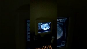 Беременность 7 недель , активное сердцебиение