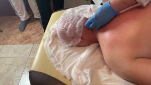 Постановка Вакуумных банок в Аль-Хиджаме. Зона № 1