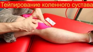 Тейпирование коленного сустава