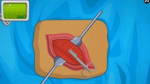 Pазвлекательныe игры - хирургия аппендицита -образовательные игры для детей