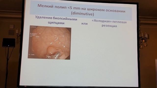 06Кашин СВ Эндоскопические методики удаления полипов толстой кишки смотреть онлайн