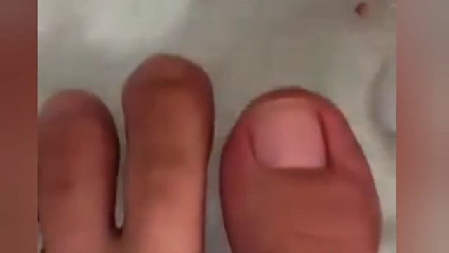 Very Lovely Cut And Clean Nails Reducing Broken Skin