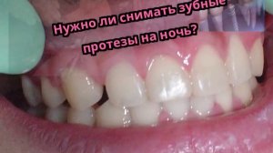 Нужно ли снимать зубные протезы на ночь?