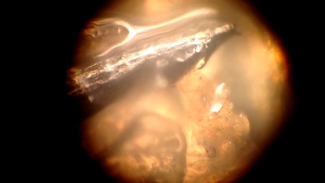 Hydre - гидра - гипотеза, которой боятся все - включите субтитры