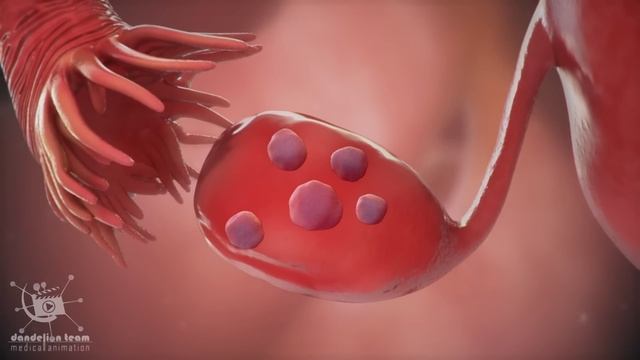 menstruation and Polycystic Ovary Syndrome or PCOS | Causes |Treatments|Dandelion Medical Animatio смотреть онлайн