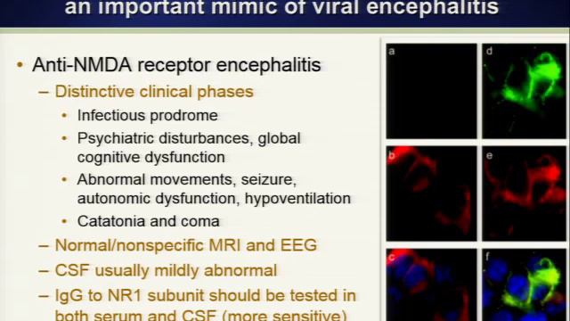 clinical approach to encephalitis смотреть онлайн