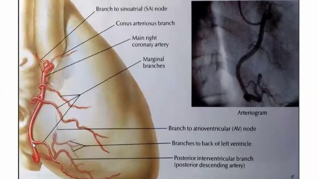 Basic Coronary Angiography (part 1) смотреть онлайн