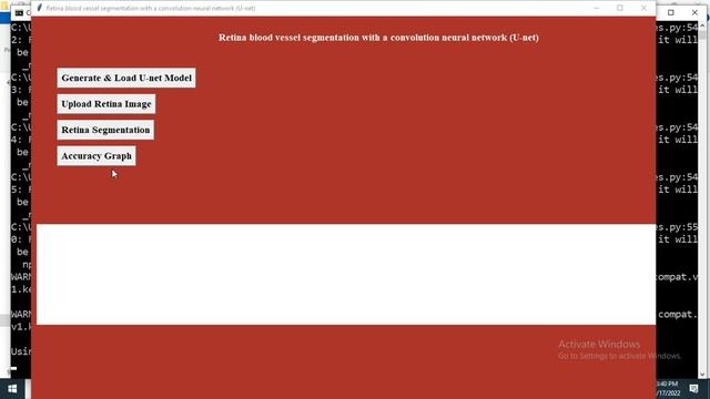 Retina blood vessel segmentation with a convolution neural network U net || Python || Deep Learning смотреть онлайн