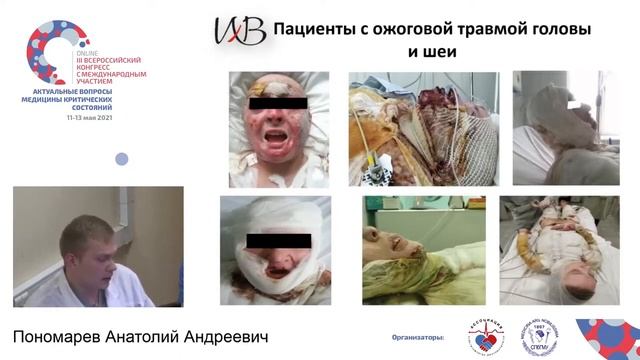 Респираторная поддержка при ожогах Пономарев А.А. смотреть онлайн