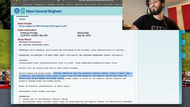 Left MRI Results In!!