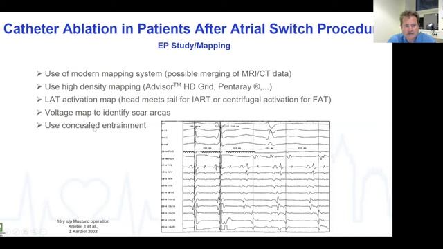 Ablation in Mustard/Senning Patients смотреть онлайн