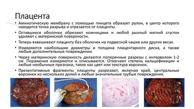 Вырезка, Градация, Репорт смотреть онлайн