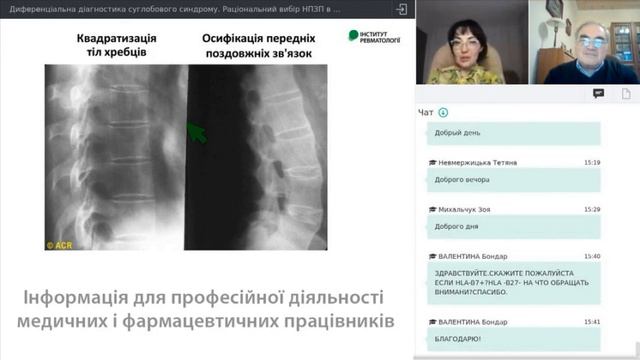 Диференціальна діагностика суглобового синдрому. Раціональний вибір НПЗП в практиці лікаря смотреть онлайн