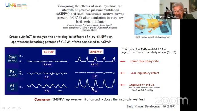 Synchronised Non Invasive Positive Pressure Ventilation in Neonates by Prof Corrado Moret смотреть онлайн