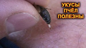 Укусы  пчёл полезны. Пчелиный яд.
