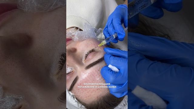 Биоревитализация смотреть онлайн
