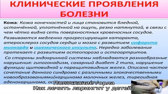 Методы лечения ларингита у ребенка в домашних условиях смотреть онлайн