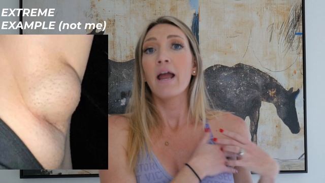 Pregnant? Here's what you should do if you find a LUMP in your armpit смотреть онлайн