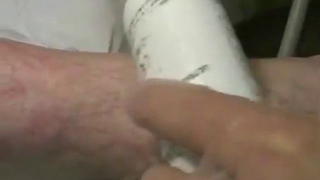 Cutera Vascular Laser Therapy смотреть онлайн