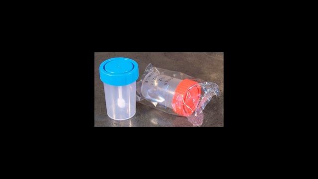 Как правильно сдавать анализ кала? смотреть онлайн