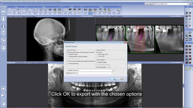 Export 2D images from Planmeca Romexis® смотреть онлайн
