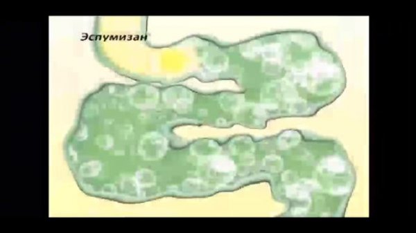 THE CRAZINESS OF ЭСПУМИЗАН