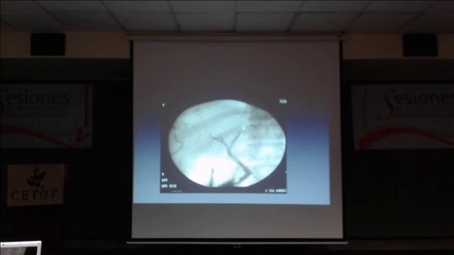 Sesiones de actualización Médica en Trasplantes смотреть онлайн