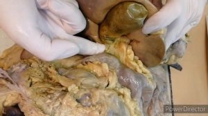 Топография брюшины