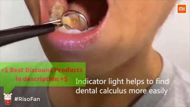 REVIEW Xiaomi Electric Sonic Dental Scaler Tooth Calculus Remover. смотреть онлайн