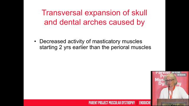PPMD 2018 Conference - Dental Considerations смотреть онлайн