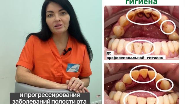 Профессиональная гигиена/ чистка Зубов смотреть онлайн