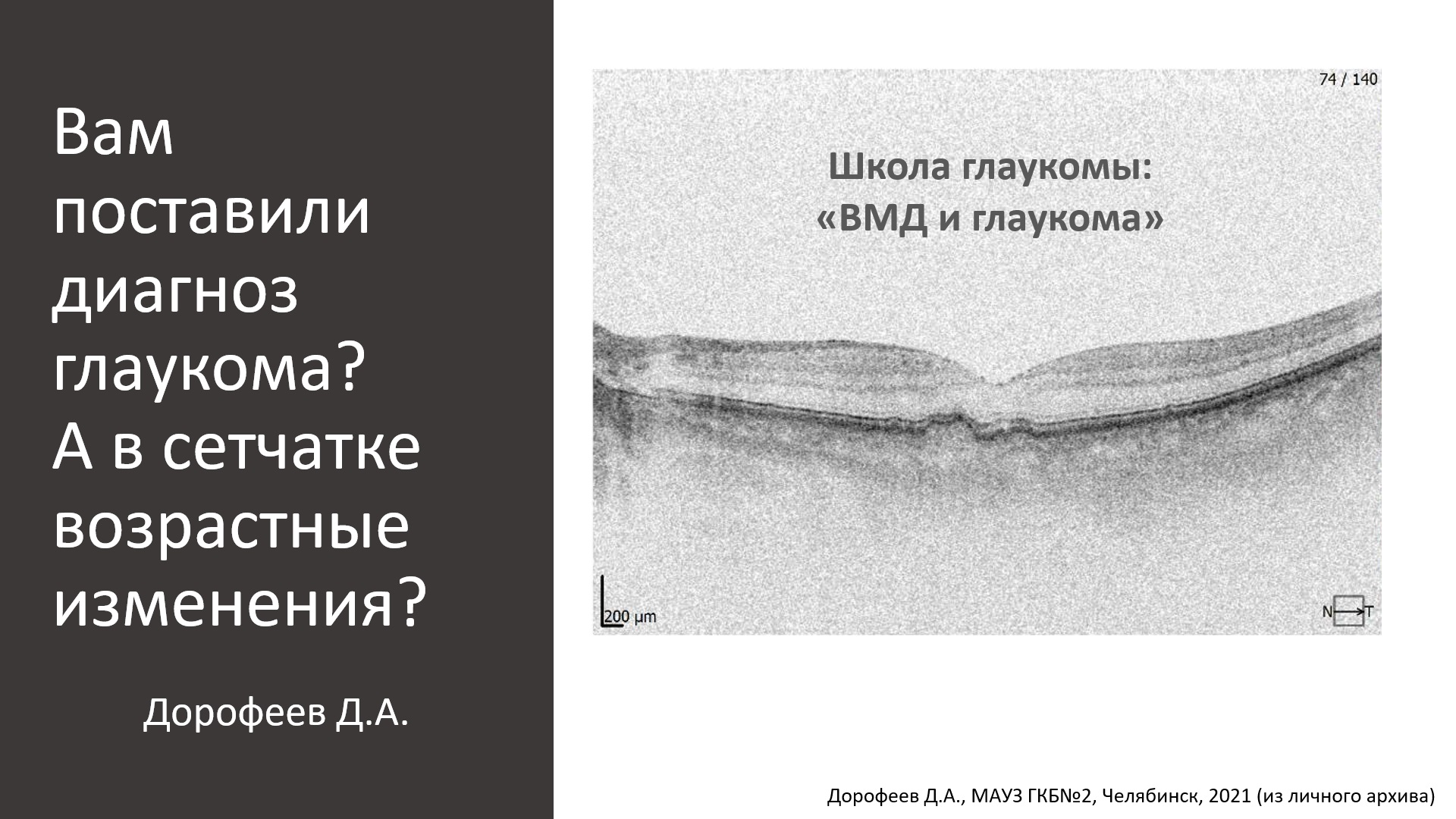Школа глаукомы. Глаукома и заболевания сетчатки