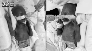 Необычные Случаи Беременности