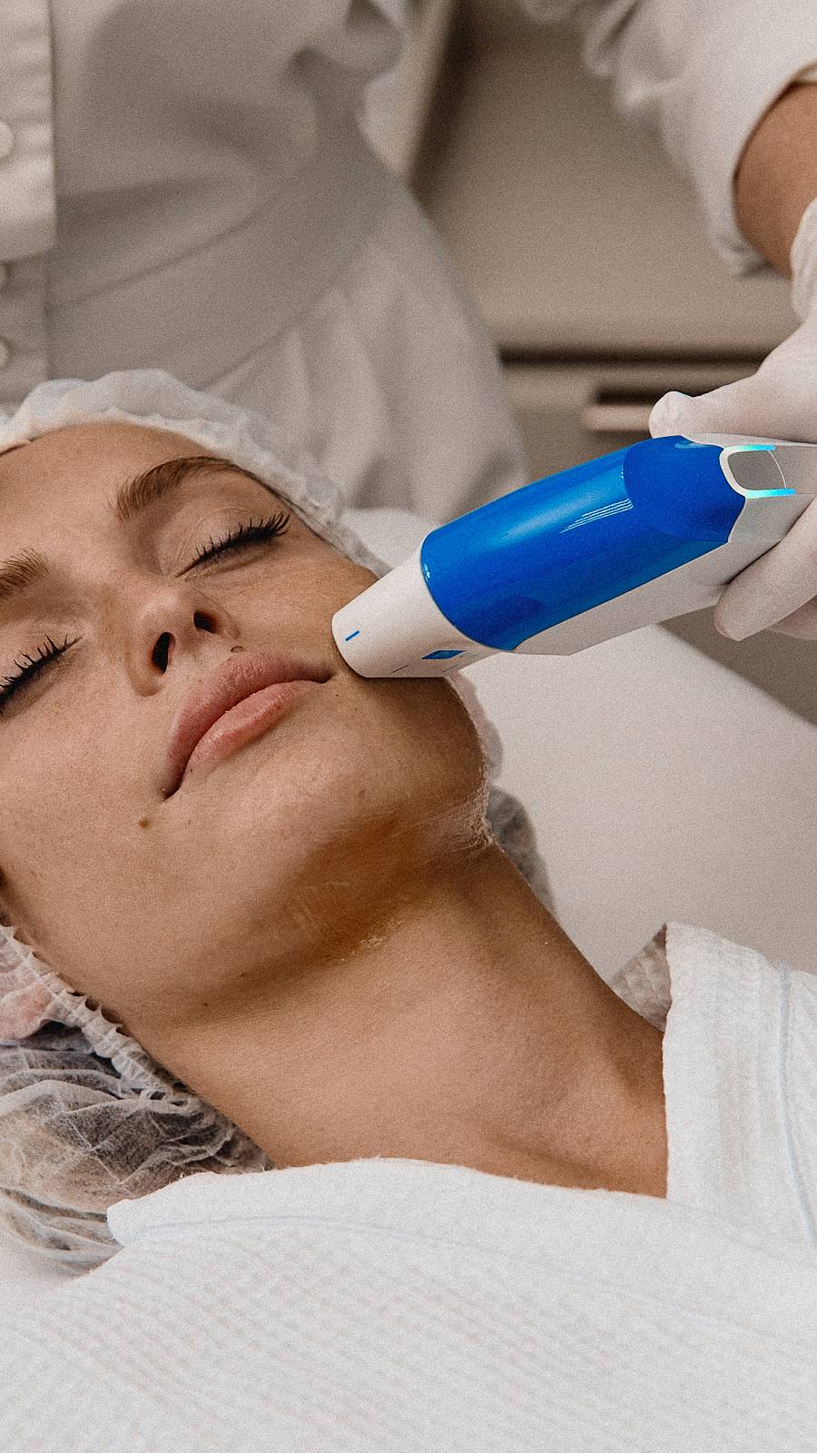 SMAS-лифтинг на аппарате Ultraformer MPT (Ультраформер). Челябинск смотреть онлайн