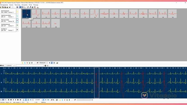 Алгоритм расшифровки данных в программе Safe Heart System смотреть онлайн