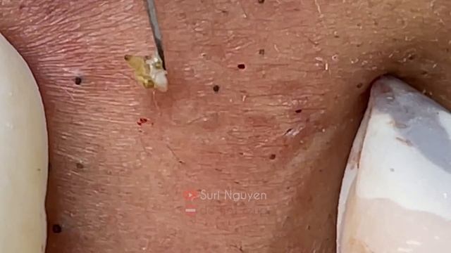 Satisfying and Relaxation with SURI NGUYEN Beauty Spa Video #478 смотреть онлайн