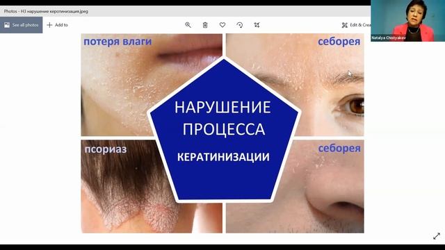 Диагностика состояния кожи. Уровень кератинизации. смотреть онлайн