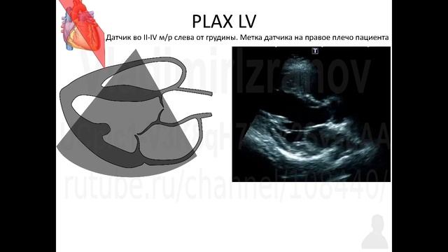 ЭхоКГ Аккредсценарий №1 Введение Часть 1 смотреть онлайн