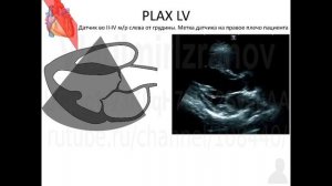 ЭхоКГ  Аккредсценарий №1  Введение  Часть 1