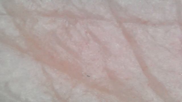 ПОД МИКРОСКОПОМ : ВОЛОСЫ, КОЖА, РОДИНКИ и др... смотреть онлайн