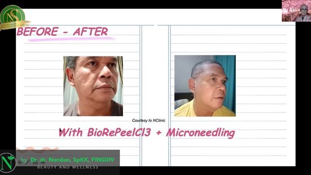 BIOREPEELCI3 full 1 смотреть онлайн