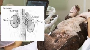 УЗИ надпочечников собаки
