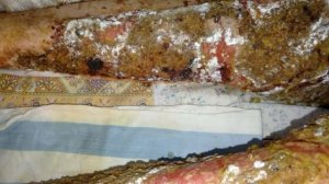 Ожог 3 степень